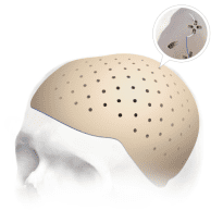 PEEK plate for cranioplasty manufacturing